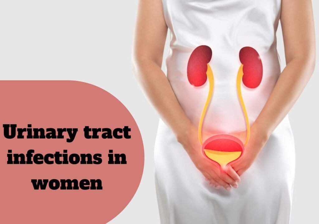 Urinary-tract-infections-in-women